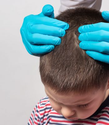 The pediatrician in the gloves will check the presence of lice and nits in a small child. Pediculosis in kindergarten, preventive examination of the head and hair
